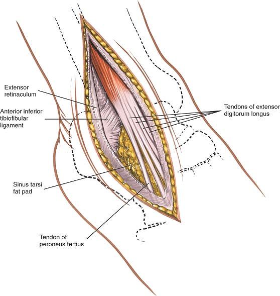 The Ankle and Foot - TeachMe Orthopedics