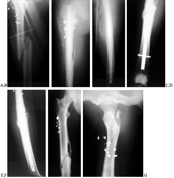 MANAGEMENT OF INFECTED IMPLANTS - TeachMe Orthopedics