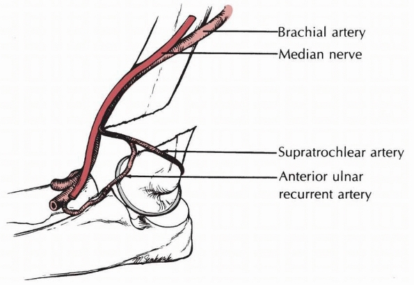 Supracondylar Fractures of the Distal Humerus - TeachMe Orthopedics