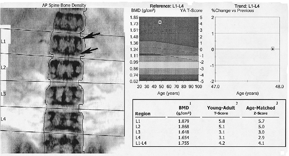 Metabolic Diseases - TeachMe Orthopedics