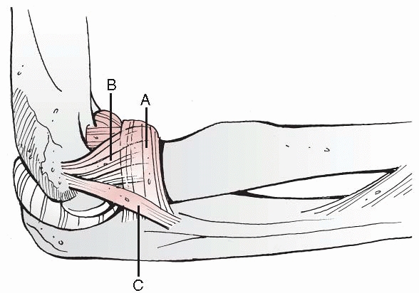 Dislocations Of The Elbow - TeachMe Orthopedics