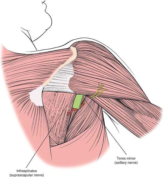 The Shoulder - TeachMe Orthopedics