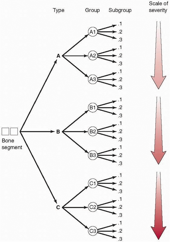 Classification of Fractures - TeachMe Orthopedics