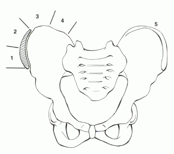 Adolescent Deformity - TeachMe Orthopedics