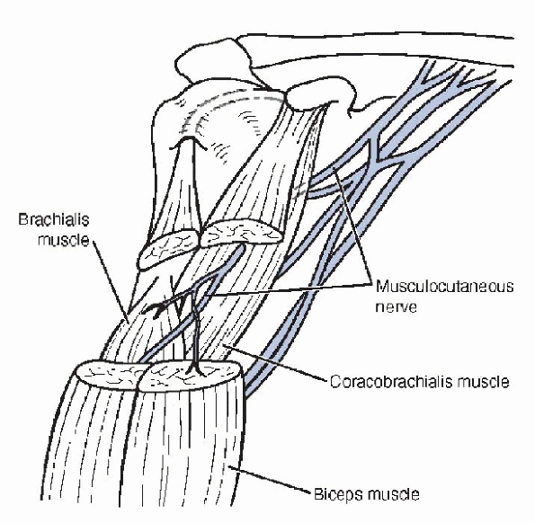 Conjoined Tendon Shoulder Anatomy - Instability | Boston Shoulder Institute - The long head of ...