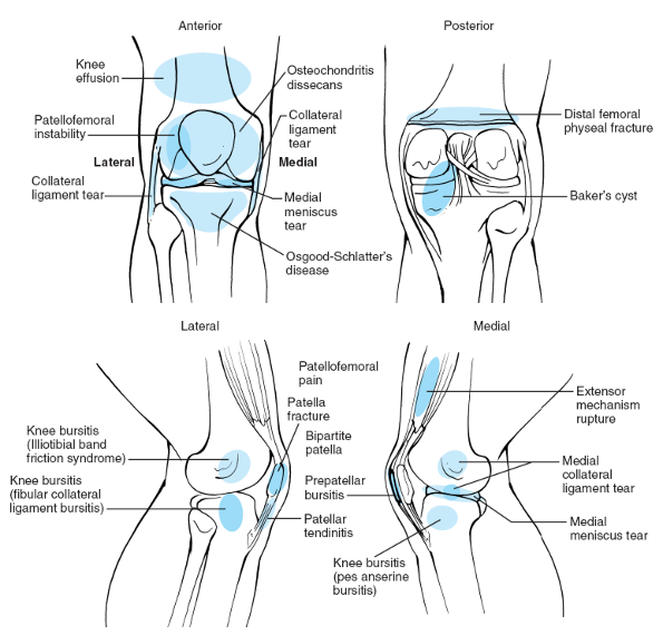 sports-medicine-teachme-orthopedics