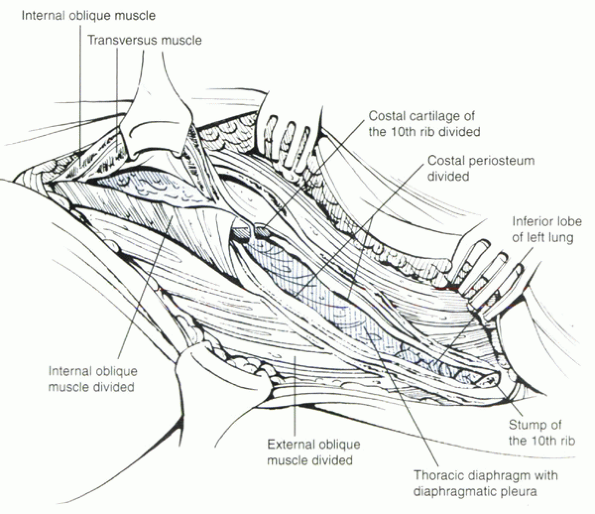 Anatomy and Approaches - TeachMe Orthopedics