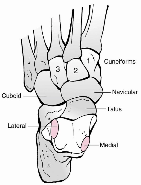 Fractures and Dislocations of the Foot - TeachMe Orthopedics