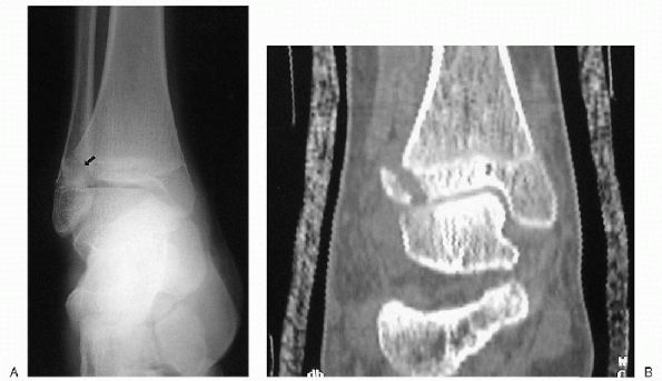 Radiology And Imaging - Teachme Orthopedics