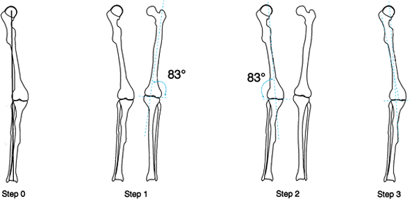 MANAGEMENT OF FRACTURES, NONUNIONS, AND MALUNIONS WITH ILIZAROV ...