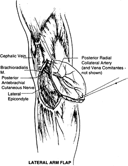 FREE TISSUE TRANSFER - TeachMe Orthopedics