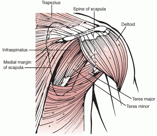 Scapular Fractures - TeachMe Orthopedics