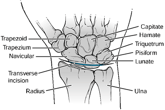 PRINCIPLES OF HAND SURGERY AND SURGICAL APPROACHES TO THE HAND AND ...