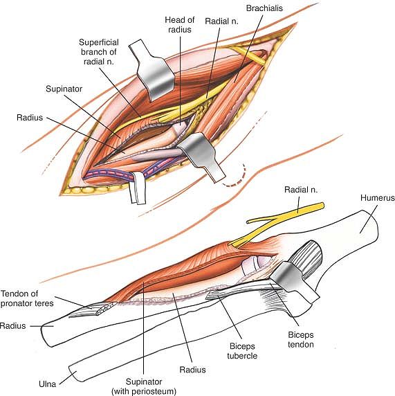 The Elbow - TeachMe Orthopedics