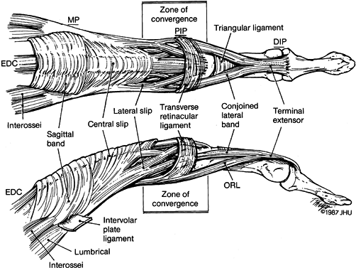 EXTENSOR TENDON INJURIES: ACUTE REPAIR AND LATE RECONSTRUCTION ...