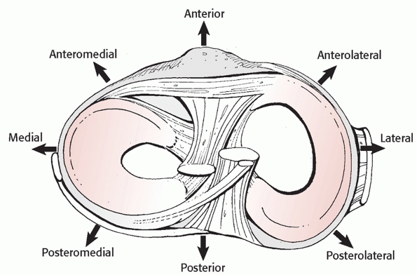 Knee Dislocations And Fracture-Dislocations - TeachMe Orthopedics