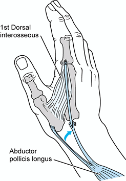 TENDON TRANSFERS IN COMBINED NERVE PALSIES OF THE FOREARM AND HAND ...