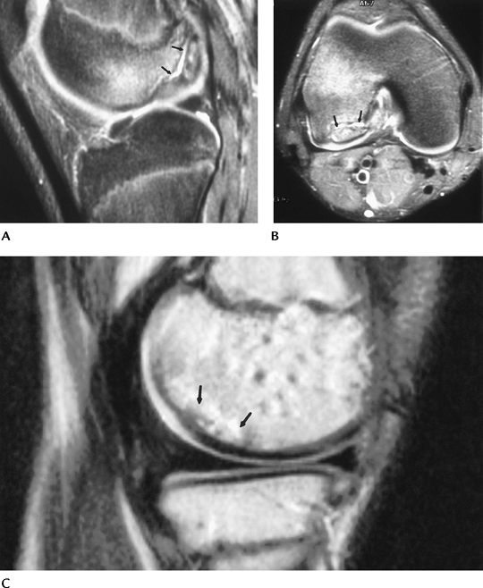 Knee - TeachMe Orthopedics