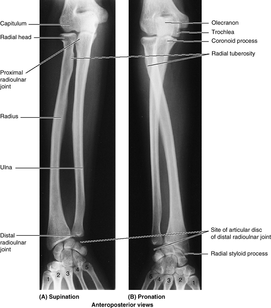 Upper Limb - TeachMe Orthopedics