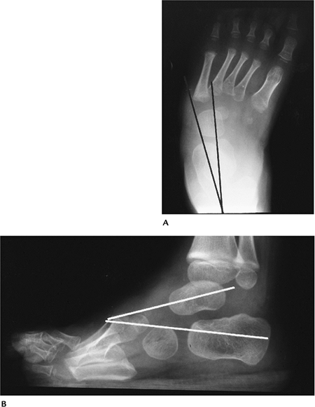 Foot, Ankle, and Calf - TeachMe Orthopedics