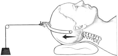 Traction - TeachMe Orthopedics