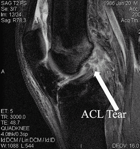 Knee Anatomy and Examination - TeachMe Orthopedics