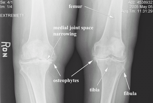 Knee Anatomy and Examination - TeachMe Orthopedics