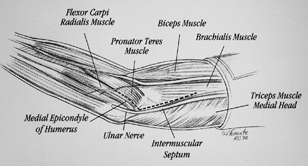 Limited and Extensile Triceps Reflecting and Exposures of the Elbow ...