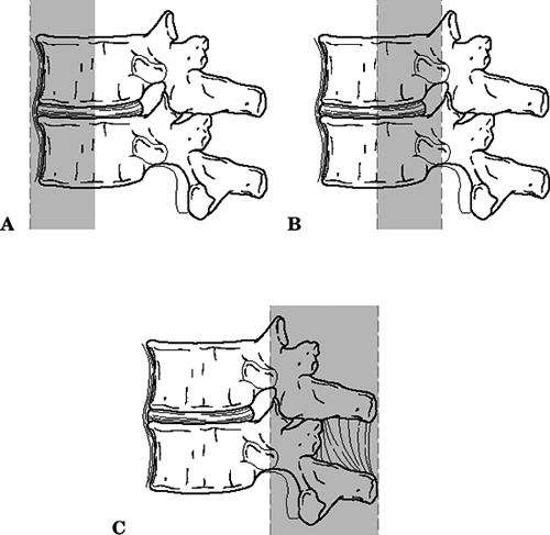 Thoracolumbar Spine - TeachMe Orthopedics