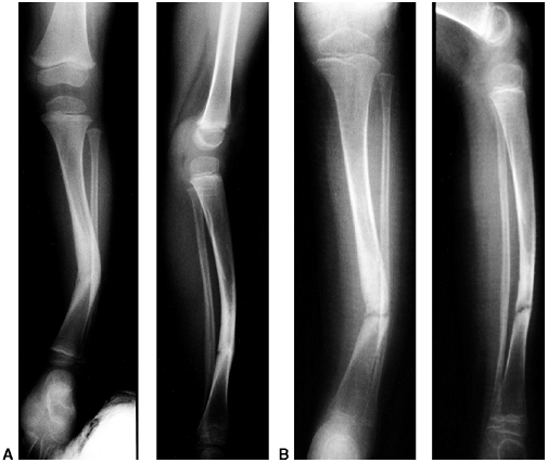 The Lower Extremity - TeachMe Orthopedics