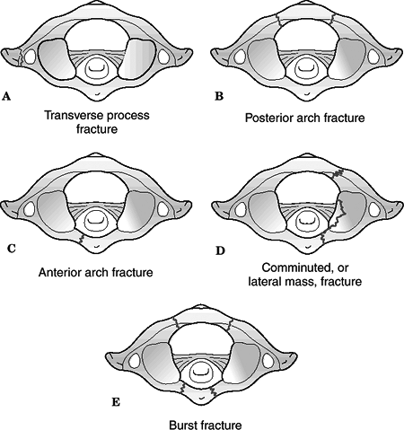 Cervical Spine - TeachMe Orthopedics