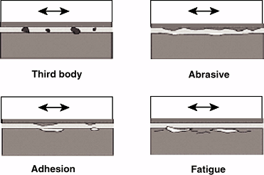 Biomechanics - TeachMe Orthopedics