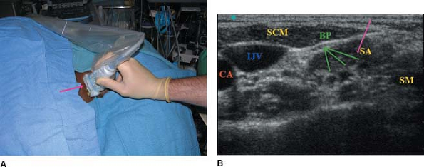 Pediatric Ultrasound - TeachMe Orthopedics