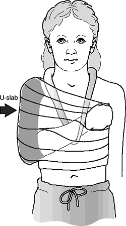 Pediatric Shoulder - TeachMe Orthopedics