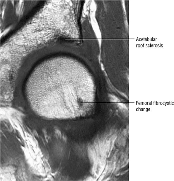 The Hip - TeachMe Orthopedics