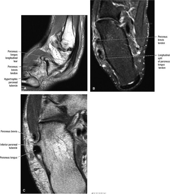 The Ankle and Foot - TeachMe Orthopedics