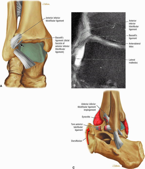 The Ankle and Foot - TeachMe Orthopedics