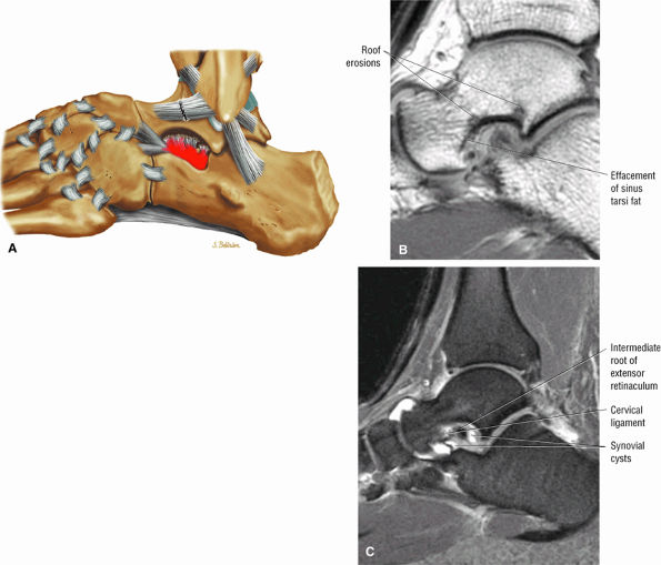 The Ankle and Foot - TeachMe Orthopedics