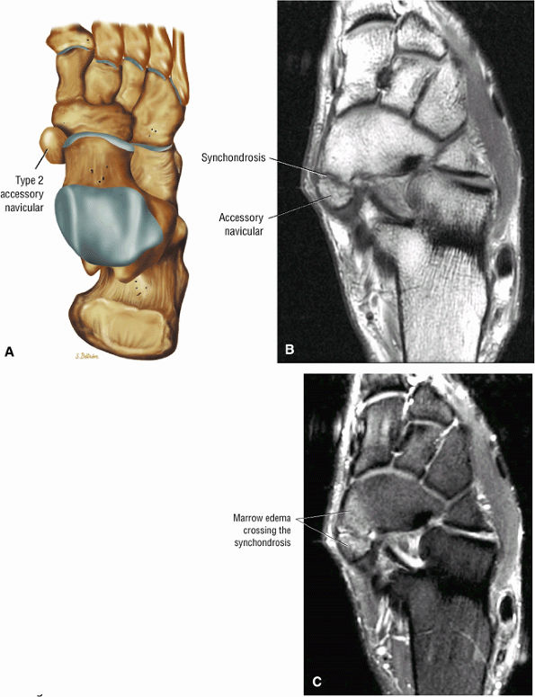 The Ankle and Foot - TeachMe Orthopedics