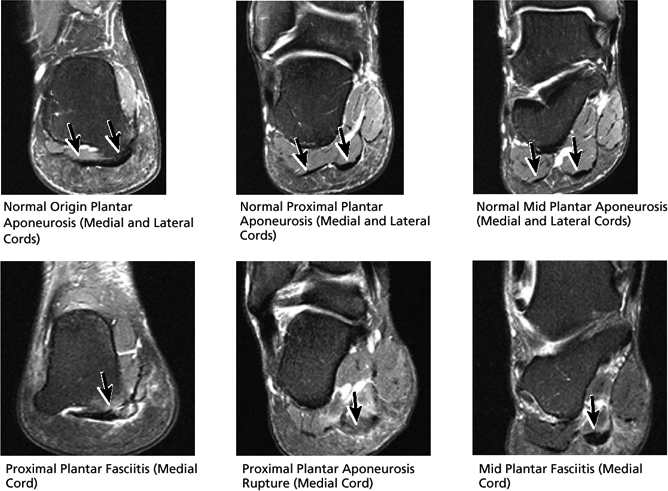 The Ankle and Foot - TeachMe Orthopedics