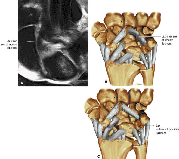 The Wrist and Hand - TeachMe Orthopedics