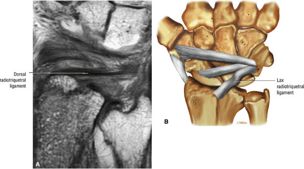 The Wrist And Hand - Teachme Orthopedics