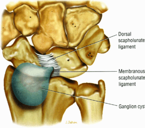 The Wrist and Hand - TeachMe Orthopedics