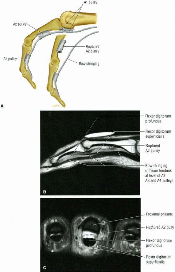 The Wrist and Hand TeachMe Orthopedics