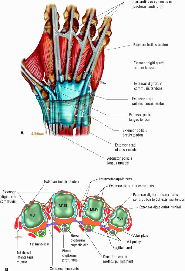 MR Imaging of the Fingers - TeachMe Orthopedics