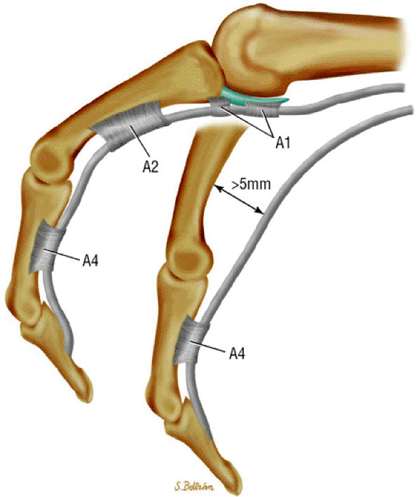 MR Imaging of the Fingers TeachMe Orthopedics