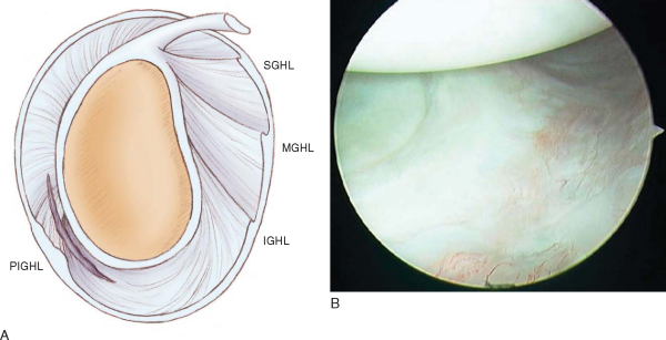 CHAPTER 10 – - TeachMe Orthopedics