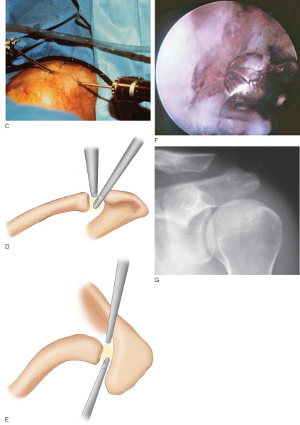 Chapter 23 Teachme Orthopedics