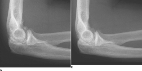 CHAPTER 35 – - TeachMe Orthopedics