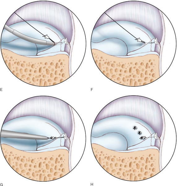 CHAPTER 46 – - TeachMe Orthopedics